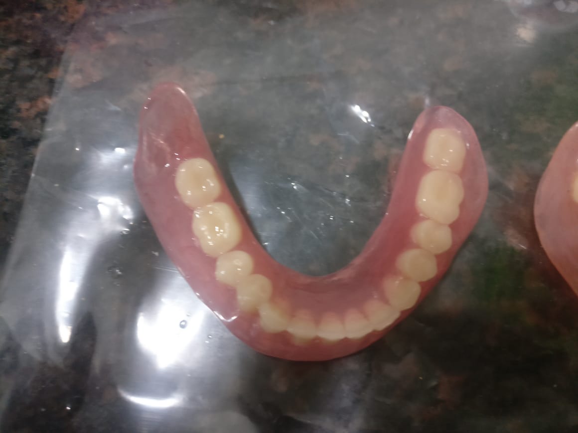 Complete and Partial Denture